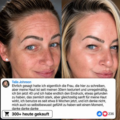 Bio-Kollagen-PDRN-Aufpolsterungsstift