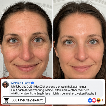 Bio-Kollagen-PDRN-Aufpolsterungsstift