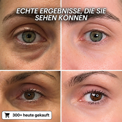 Bio-Kollagen-PDRN-Aufpolsterungsstift